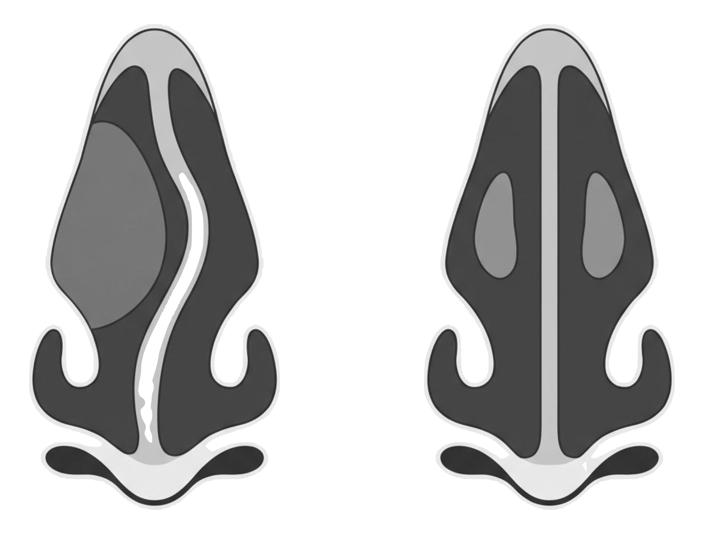 Surgical Nasal Airway Procedures